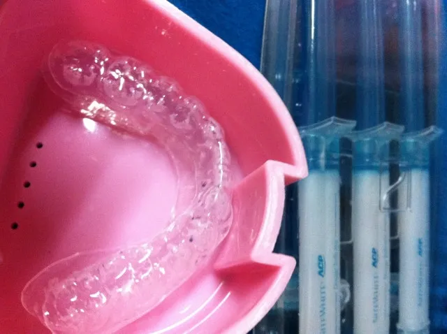 【加須】審美歯科のホワイトニングの効果と費用